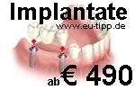 Zahnbehandlung Urlaub - 1 Woche Euro 299 all inclusive